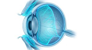 결막이완증의 의학적 구조를 보여주는 3D 일러스트